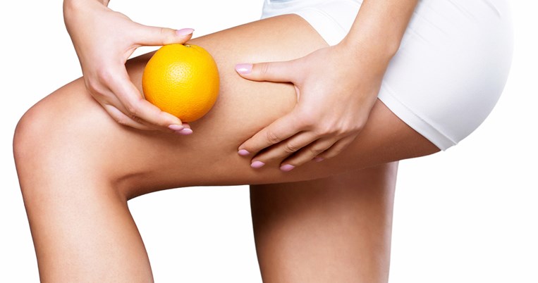 5 φυσικοί τρόποι για να απαλλαγείς οριστικά από την κυτταρίτιδα