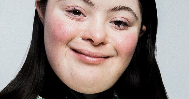 O καλός «θάνατος» του στερεότυπου. Ένα μοντέλο με σύνδρομο Down στη νέα καμπάνια του οίκου Gucci