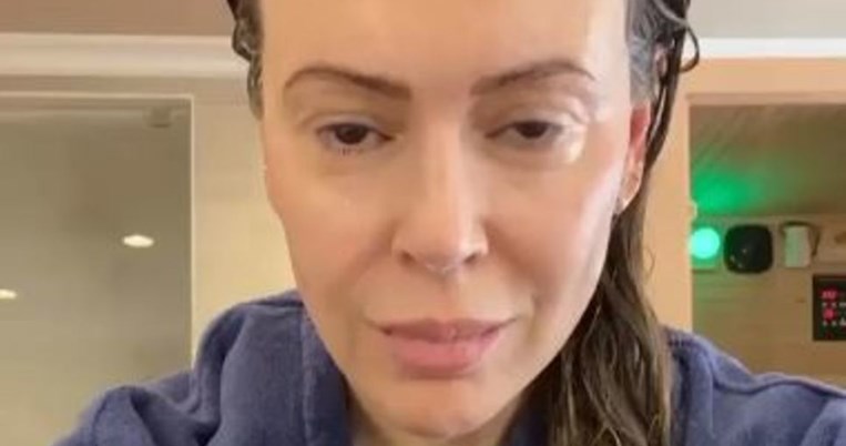 Της έμειναν τα μαλλιά στα χέρια: Η Αλίσα Μιλάνο δείχνει τη δραματική τριχόπτωση μετά τον κορονοϊό