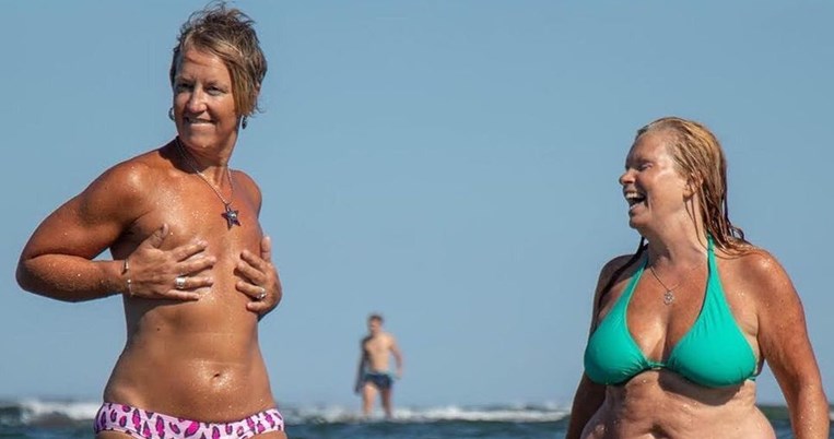«Το στήθος μου συνταξιοδοτήθηκε πρόωρα»: Τόπλες στην παραλία μετά από διπλή μαστεκτομή 