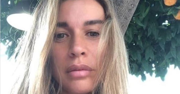Η αινιγματική ανάρτηση της Έρρικας Πρεζεράκου δυο μήνες μετά τον ακρωτηριασμό