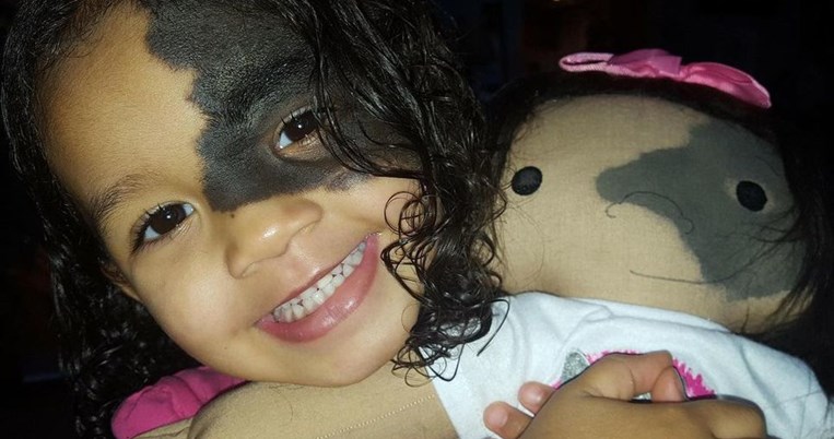 Η δημιουργός που φτιάχνει κούκλες-σωσίες παιδιών με σωματικές αναπηρίες και δυσμορφίες