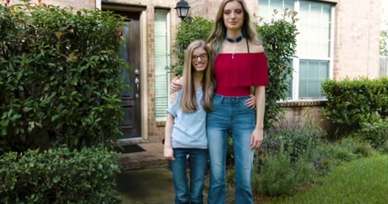 «Νομίζουν ότι είμαι κόρη της»: Οι μοναδικές δίδυμες αδερφές στον κόσμο που η μία πάσχει από νανισμό