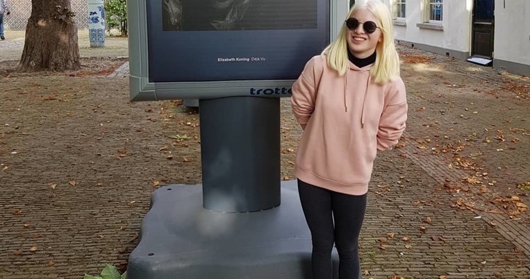 Γεννήθηκε με αλμπινισμό, εγκαταλείφθηκε όταν ήταν μωρό. Σήμερα είναι μοντέλο κορυφαίων brands