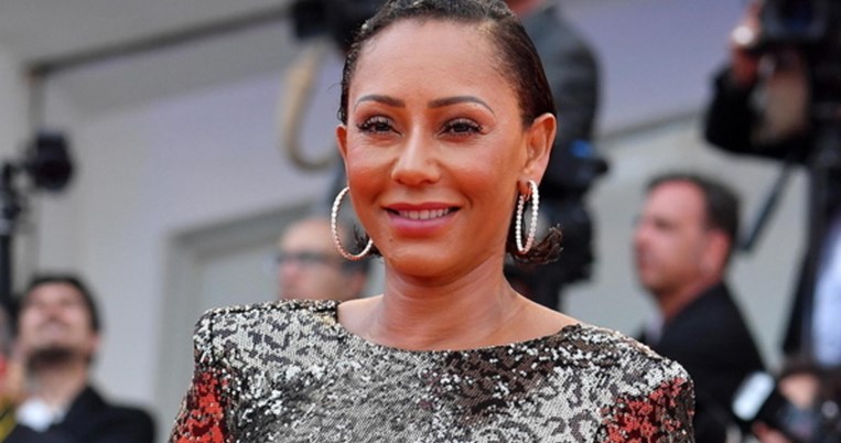 Με μώλωπες και σημάδια στο πρόσωπο εμφανίστηκε η διάσημη τραγουδίστρια