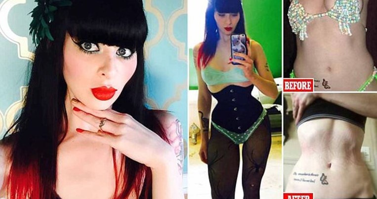 Φοράει 22 ώρες την ημέρα έναν στενό κoρσέ για να αποκτήσει μέση-κλεψύδρα