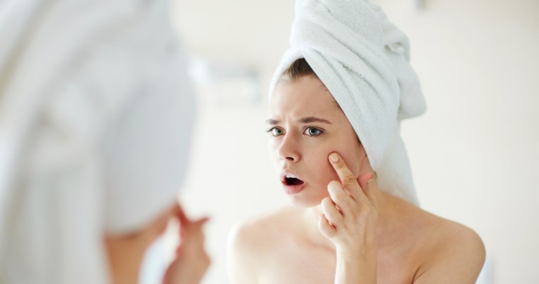 4 φυσικοί και οικονομικοί τρόποι για να εξαφανίσεις τα σπυράκια