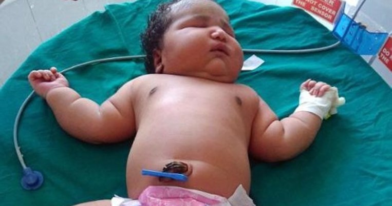 Το βαρύτερο κορίτσι στον κόσμο γεννήθηκε στην Ινδία. Πόσο ζυγίζει; 