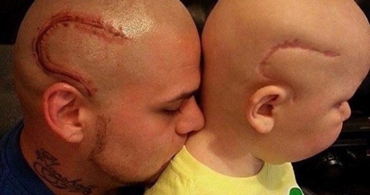 Το συγκλονιστικό τατουάζ που έκανε ένας άνδρας για να συμπαρασταθεί στον καρκινοπαθή γιο του 