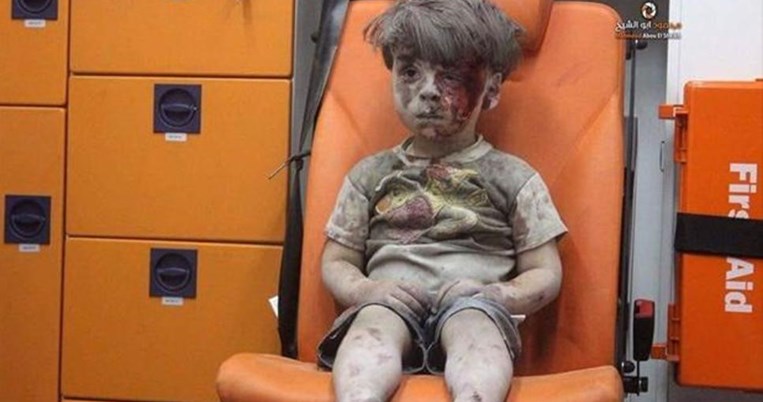 Η εκκωφαντική σιωπή ενός τραυματισμένου αγοριού στη Συρία σε ένα σοκαριστικό βίντεο