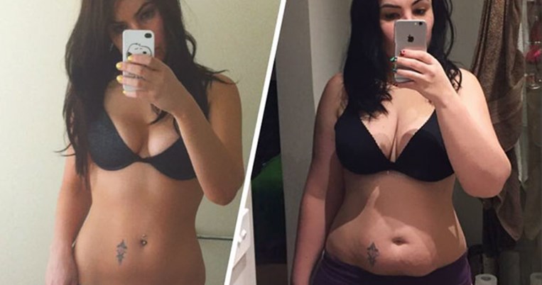 Μια μαμά ανέβασε φωτογραφίες με το σώμα της πριν και μετά τον τοκετό, σπάζοντας όλα τα ταμπού