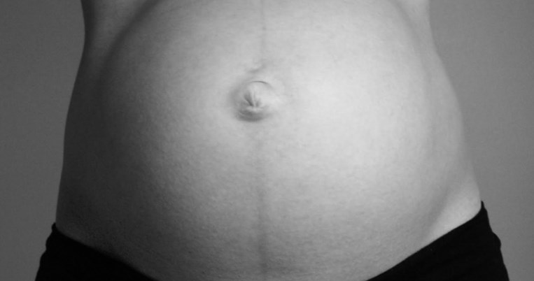Γιατί δημιουργείται η μαύρη γραμμή στην κοιλιά μιας εγκύου