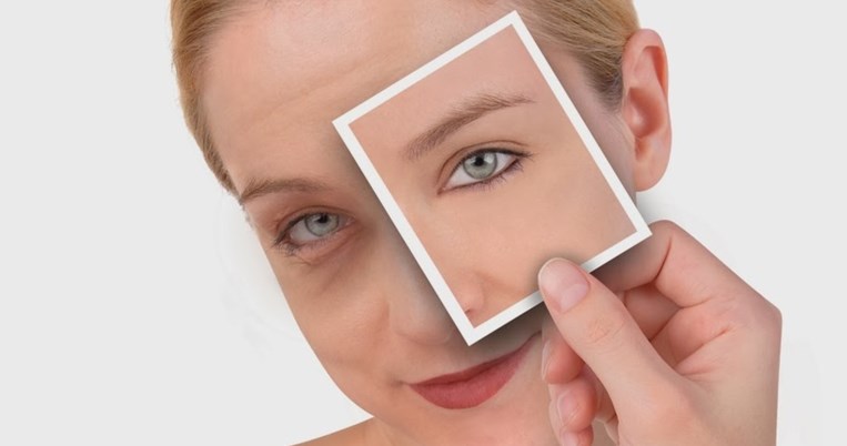 Οι τροφές που μειώνουν αισθητά τις σακούλες στα μάτια