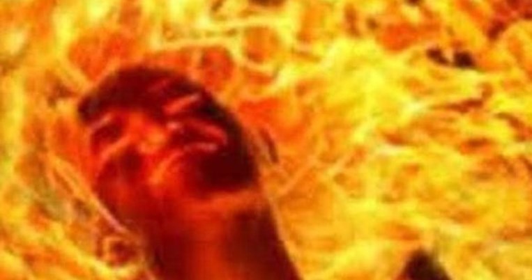 Το ατύχημα Ελληνίδας ηθοποιού που δεν ήξερε κανείς. «Έκαψα όλο το πρόσωπό μου και…»