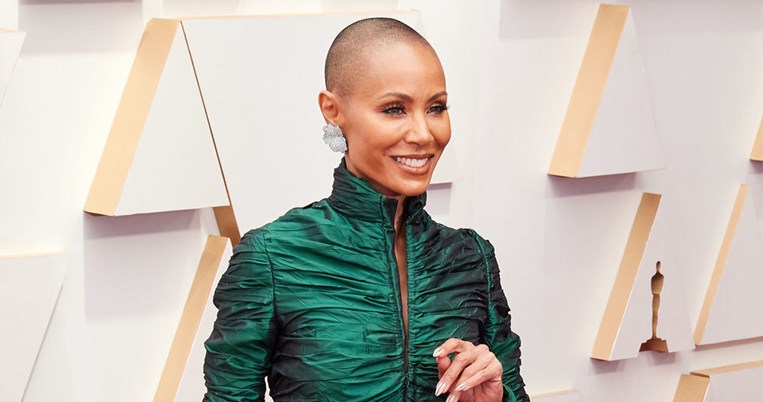 Τι ακριβώς είναι η αλωπεκία; Όσα πρέπει να ξέρεις για το αυτοάνοσο