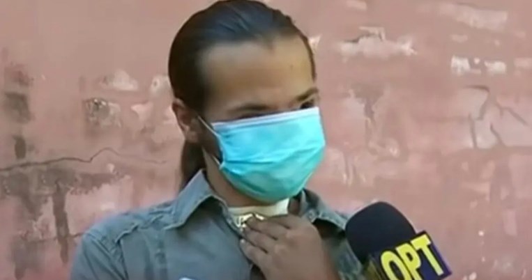 Ποιος κάνει ακόμα bullying σε ανθρώπους με παραμόρφωση στο πρόσωπο;