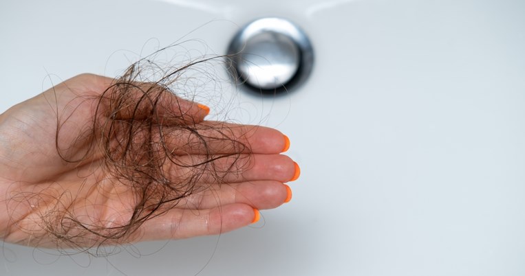 μαλλιά, τριχόπτωση