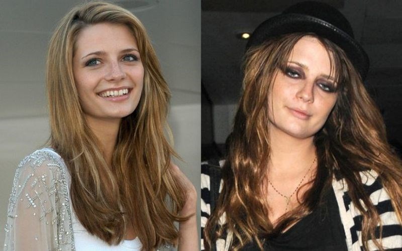 14 διάσημοι πριν και μετά τον εθισμό στα ναρκωτικά
